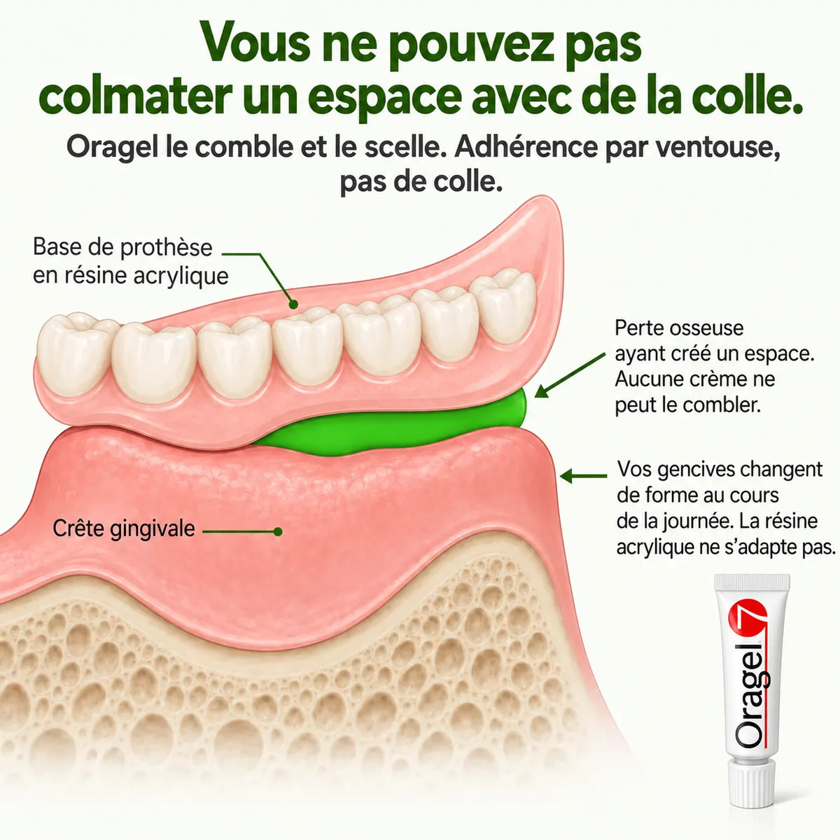 Oragel™ | Stoppe 100 % des glissements de prothèses dentaires – Maintien sûr toute la journée